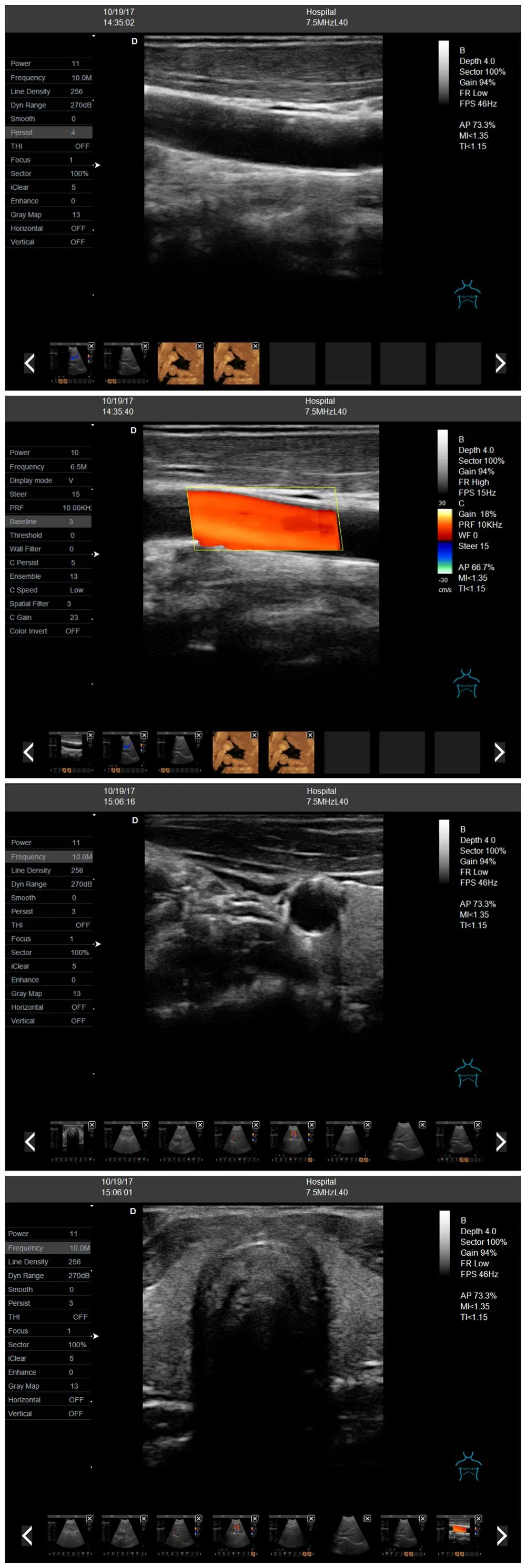 4D 5D Color Ultrasonic Diagnostic Apparatus, Portable Color Doppler Ultrasound Scanner Mslcu64