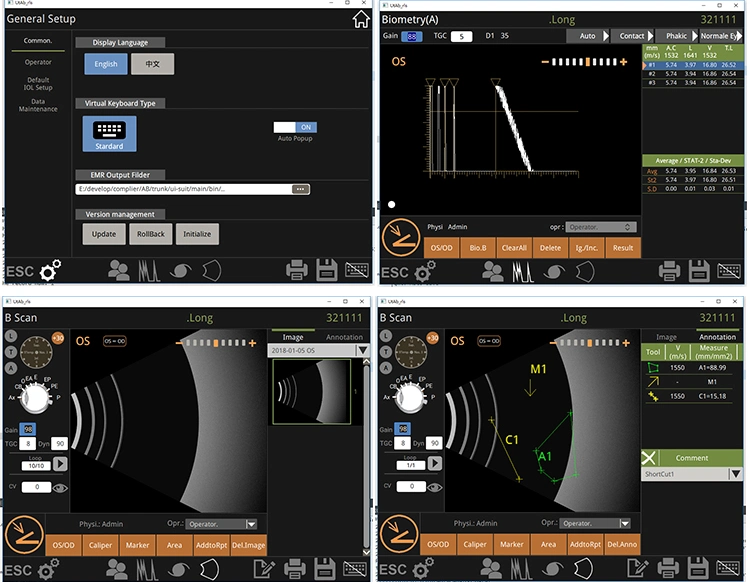 Ophthalmic Ultrasound B Scan Ultrasonic a/B Scanner for Ophthalmology