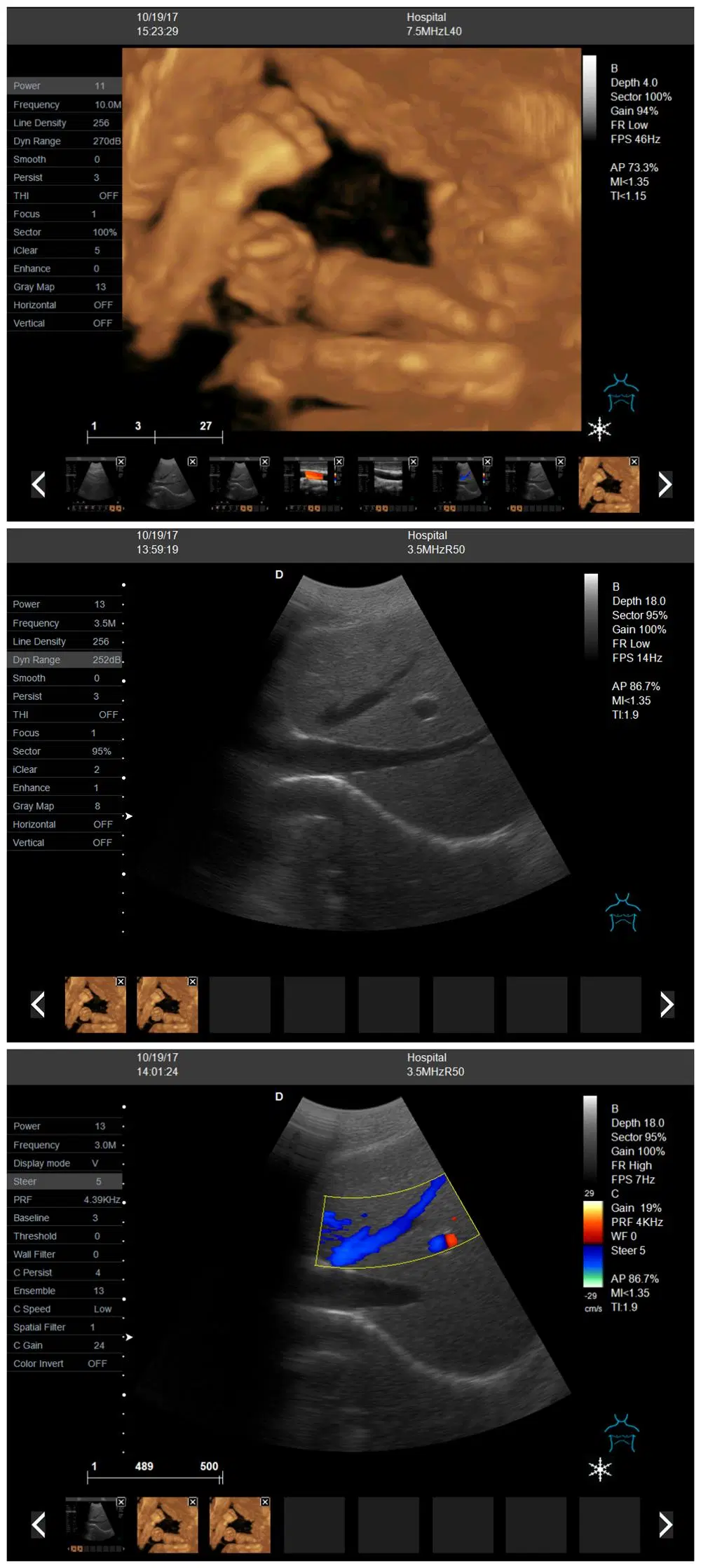 4D 5D Color Ultrasonic Diagnostic Apparatus, Portable Color Doppler Ultrasound Scanner Mslcu64