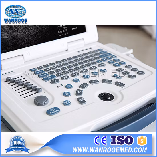 デジタルポータブル超音波診断装置超音波スキャナー